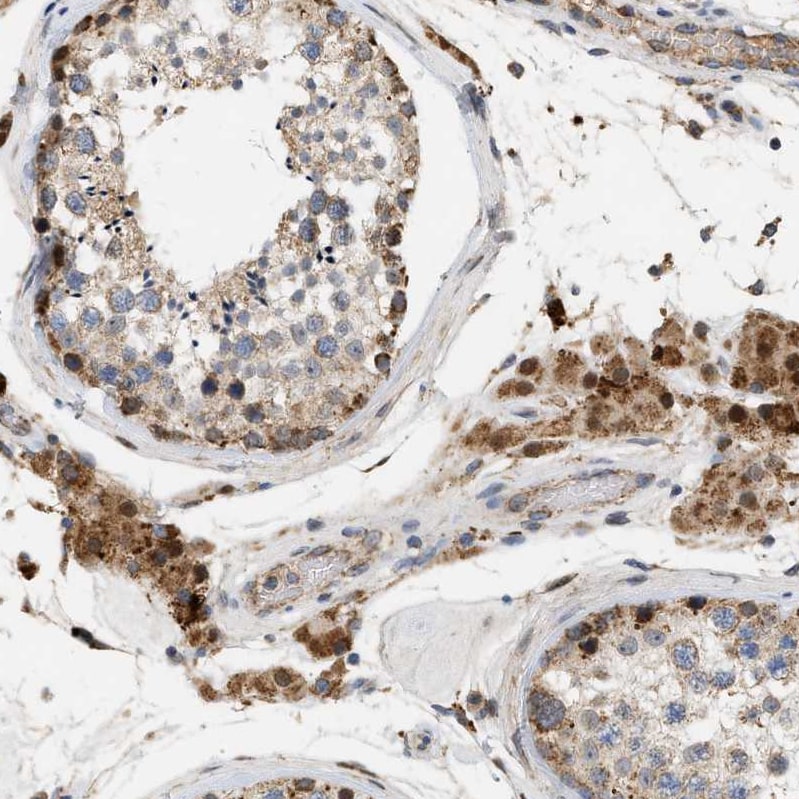 CCDC109A Antibody Immunohistochemistry-Paraffin: CCDC109A Antibody [NBP1-88534]