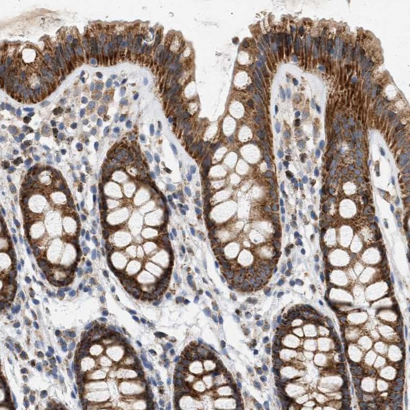 CCDC109A Antibody Immunohistochemistry-Paraffin: CCDC109A Antibody [NBP1-88534]
