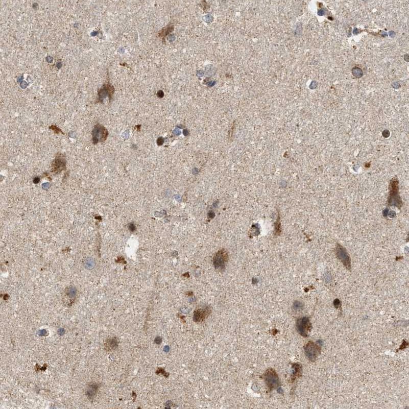 CCDC109A Antibody Immunohistochemistry-Paraffin: CCDC109A Antibody [NBP1-88534]