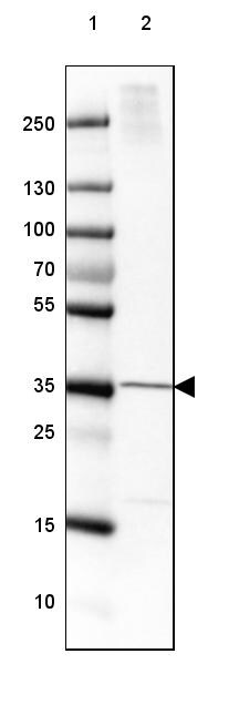 FAM107B Antibody - BSA Free Western Blot: FAM107B Antibody - BSA Free [NBP1-88535]
