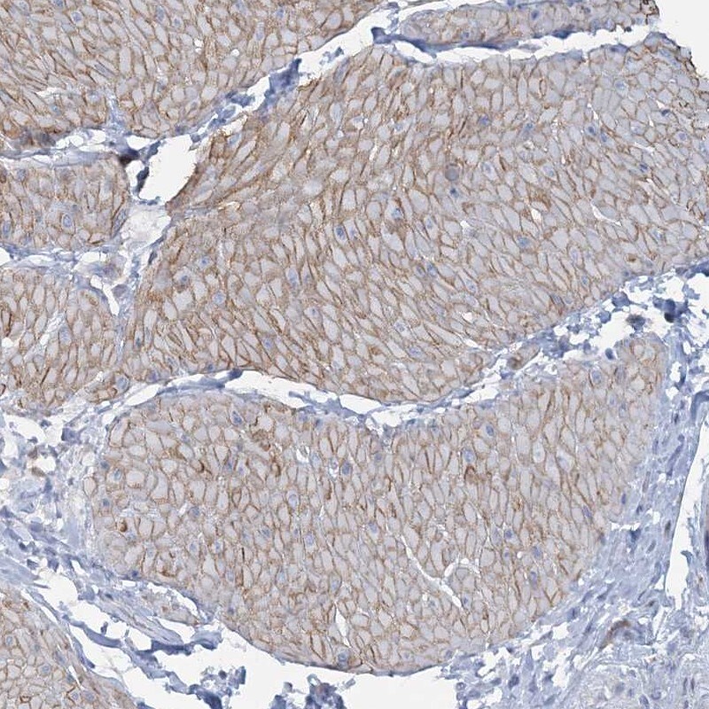 CUEDC2 Antibody - BSA Free Immunohistochemistry-Paraffin: CUEDC2 Antibody [NBP1-88538]