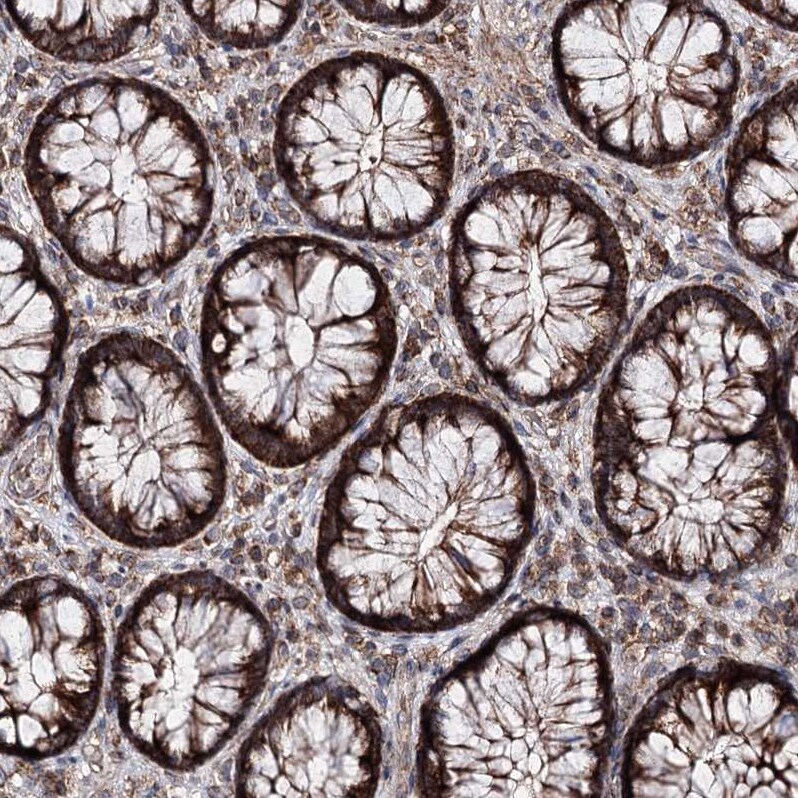 MINDY3 Antibody - BSA Free Immunohistochemistry-Paraffin: MINDY3 Antibody - BSA Free [NBP1-88543]