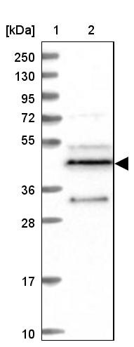 MINDY3 Antibody - BSA Free Western Blot: MINDY3 Antibody - BSA Free [NBP1-88543]