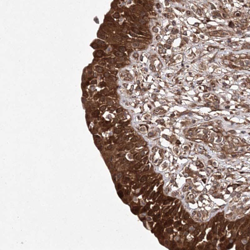 TMEM9B Antibody - BSA Free Immunohistochemistry-Paraffin: TMEM9B Antibody [NBP1-88545]