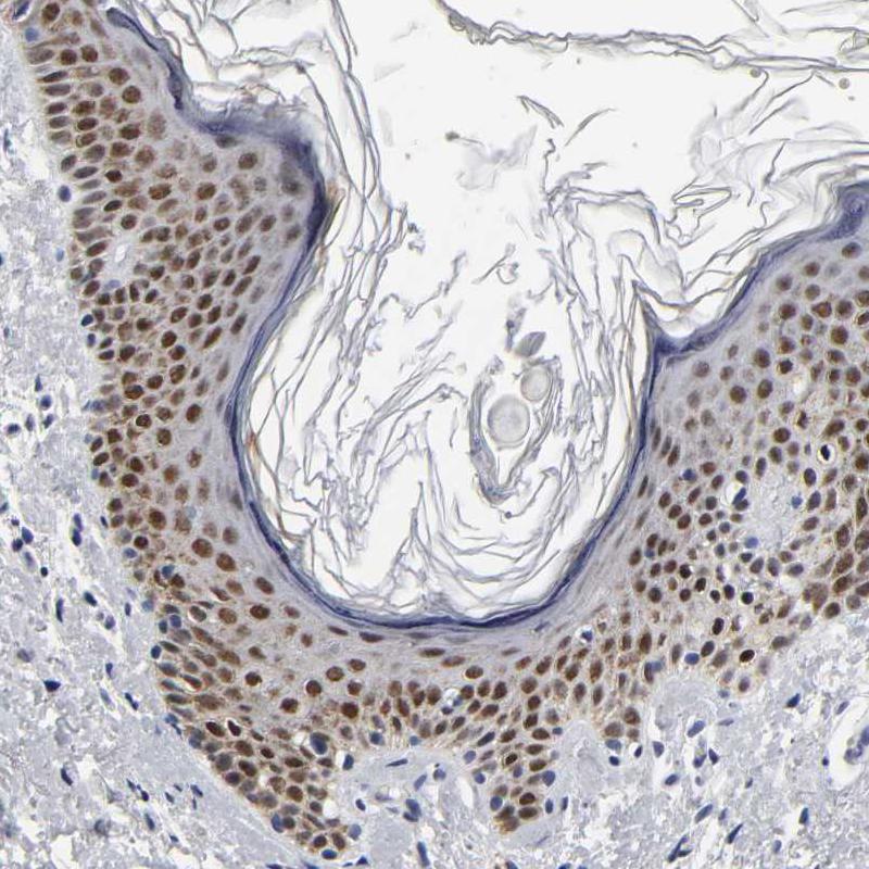 GRHL2 Antibody - BSA Free Immunohistochemistry-Paraffin: GRHL2 Antibody - BSA Free [NBP1-88552]