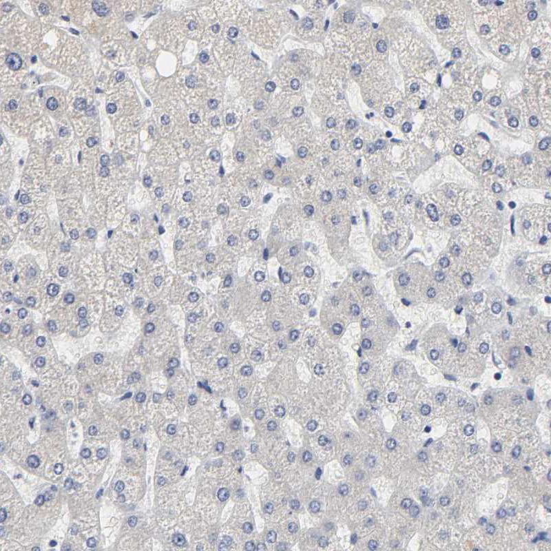 GRHL2 Antibody - BSA Free Immunohistochemistry-Paraffin: GRHL2 Antibody - BSA Free [NBP1-88552]