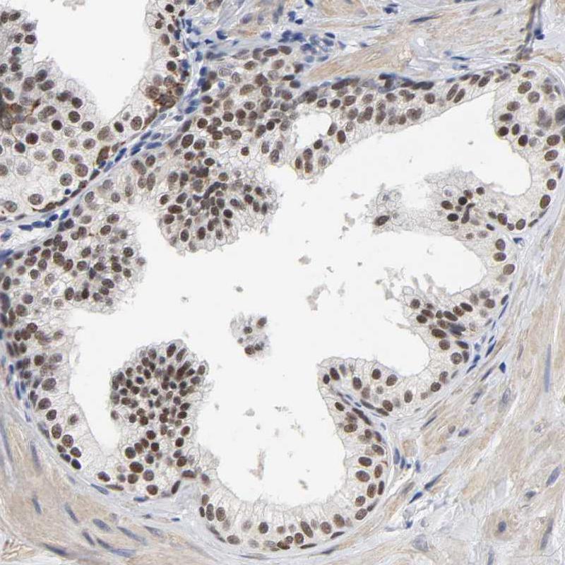 GRHL2 Antibody - BSA Free Immunohistochemistry-Paraffin: GRHL2 Antibody - BSA Free [NBP1-88552]