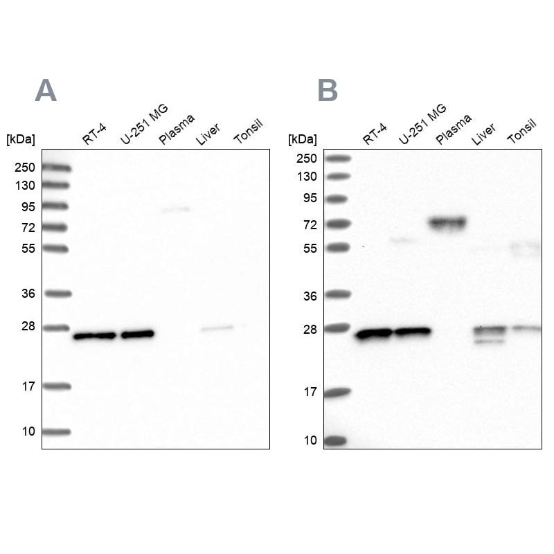MESDC2 Antibody - BSA Free Western Blot: MESDC2 Antibody - BSA Free [NBP1-88555]