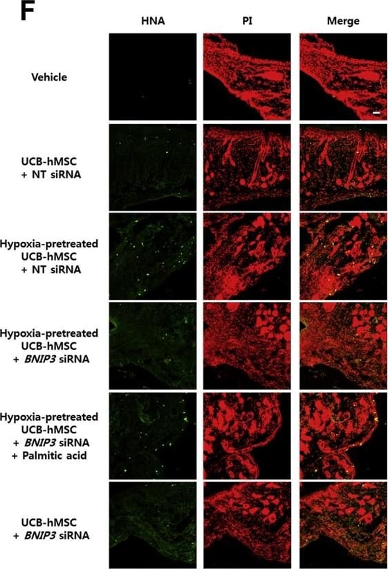 BNIP3L Antibody