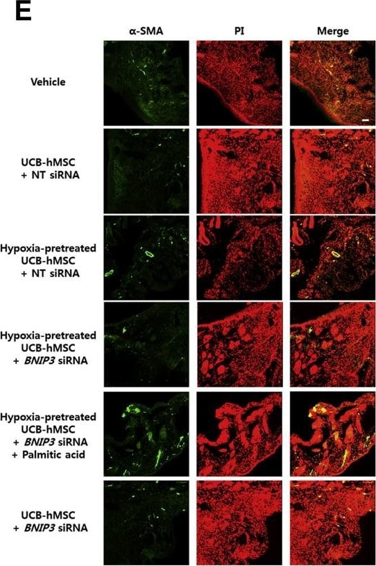 BNIP3L Antibody