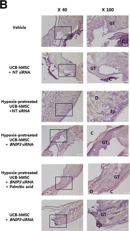 BNIP3L Antibody