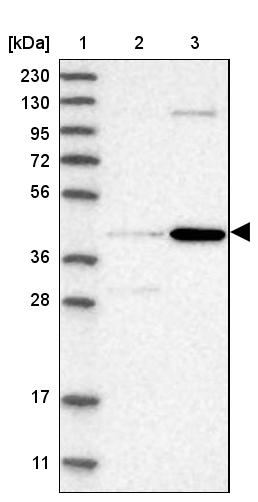 Chordin-like 2/CHRDL2 Antibody - BSA Free Western Blot: Chordin-like 2/CHRDL2 Antibody - BSA Free [NBP1-88560]
