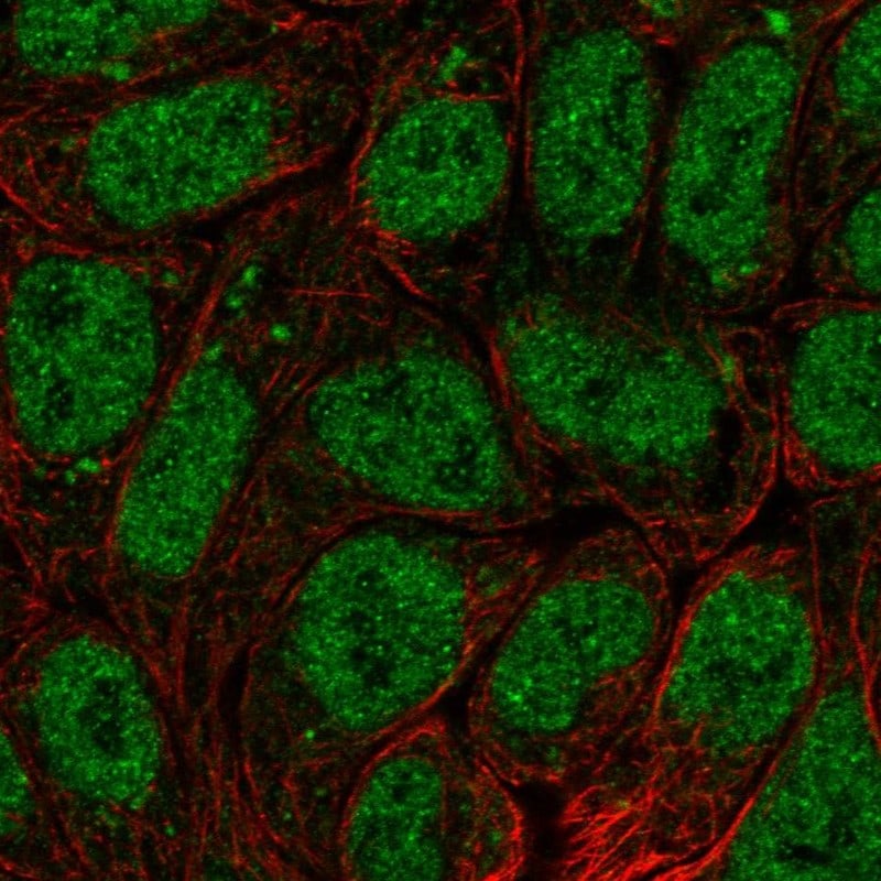BRI3BP Antibody - BSA Free Immunocytochemistry/ Immunofluorescence: BRI3BP Antibody [NBP1-88564]