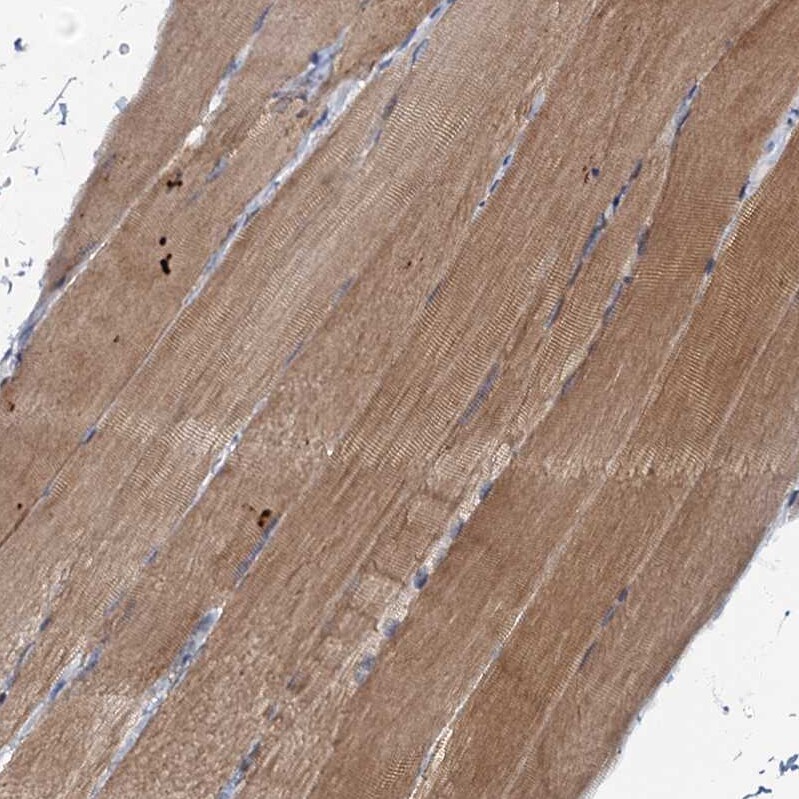 MRPL51 Antibody - BSA Free Immunohistochemistry-Paraffin: MRPL51 Antibody [NBP1-88567]