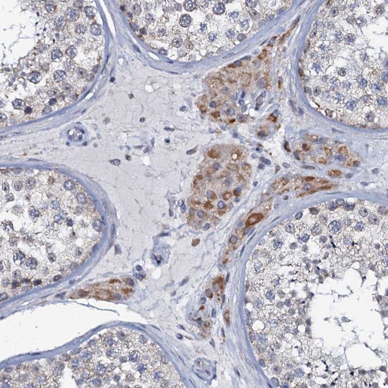 MRPL51 Antibody - BSA Free Immunohistochemistry-Paraffin: MRPL51 Antibody [NBP1-88567]