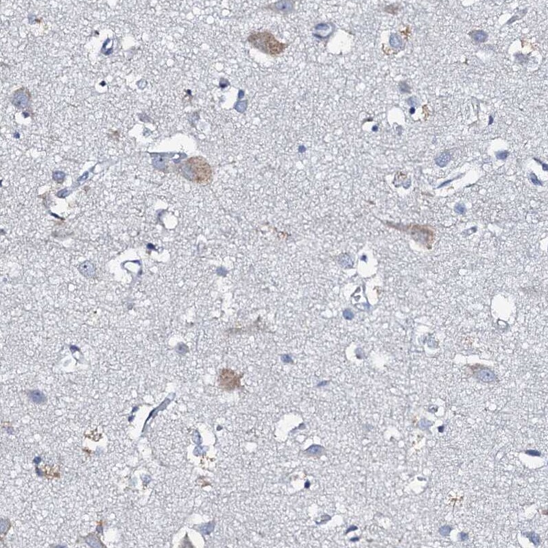 MRPL51 Antibody - BSA Free Immunohistochemistry-Paraffin: MRPL51 Antibody [NBP1-88567]