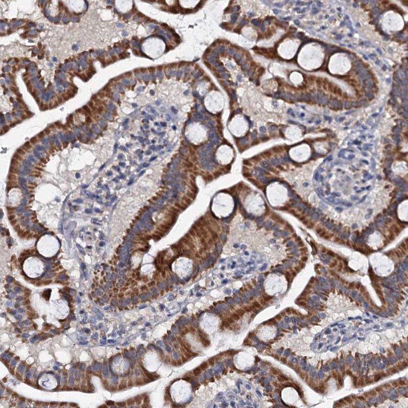 MRPL51 Antibody - BSA Free Immunohistochemistry-Paraffin: MRPL51 Antibody [NBP1-88567]