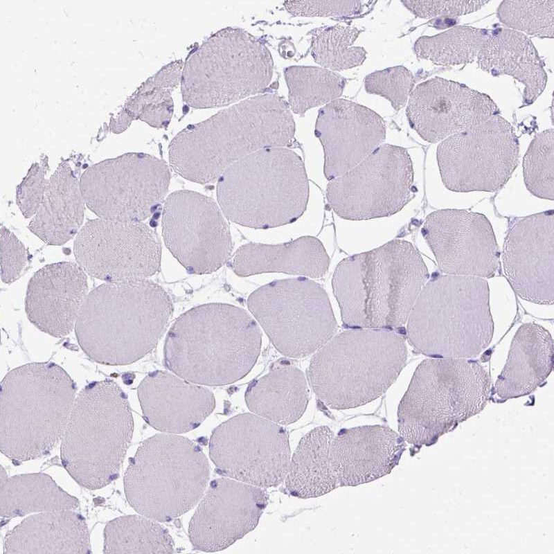 MBP-1 Antibody - BSA Free Immunohistochemistry-Paraffin: MBP-1 Antibody [NBP1-88573]