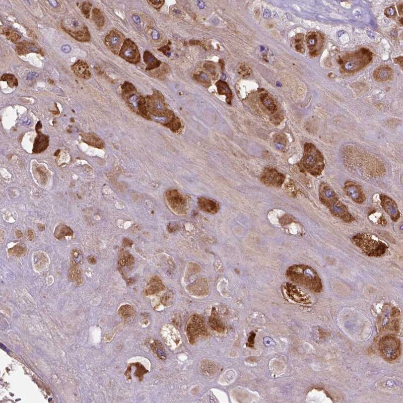 MBP-1 Antibody - BSA Free Immunohistochemistry-Paraffin: MBP-1 Antibody [NBP1-88573]