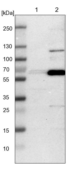 GDF-5/BMP-14 Antibody - BSA Free Western Blot: GDF-5/BMP-14 Antibody - BSA Free [NBP1-88575]