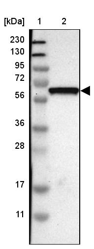 GDF-5/BMP-14 Antibody - BSA Free Western Blot: GDF-5/BMP-14 Antibody - BSA Free [NBP1-88575]