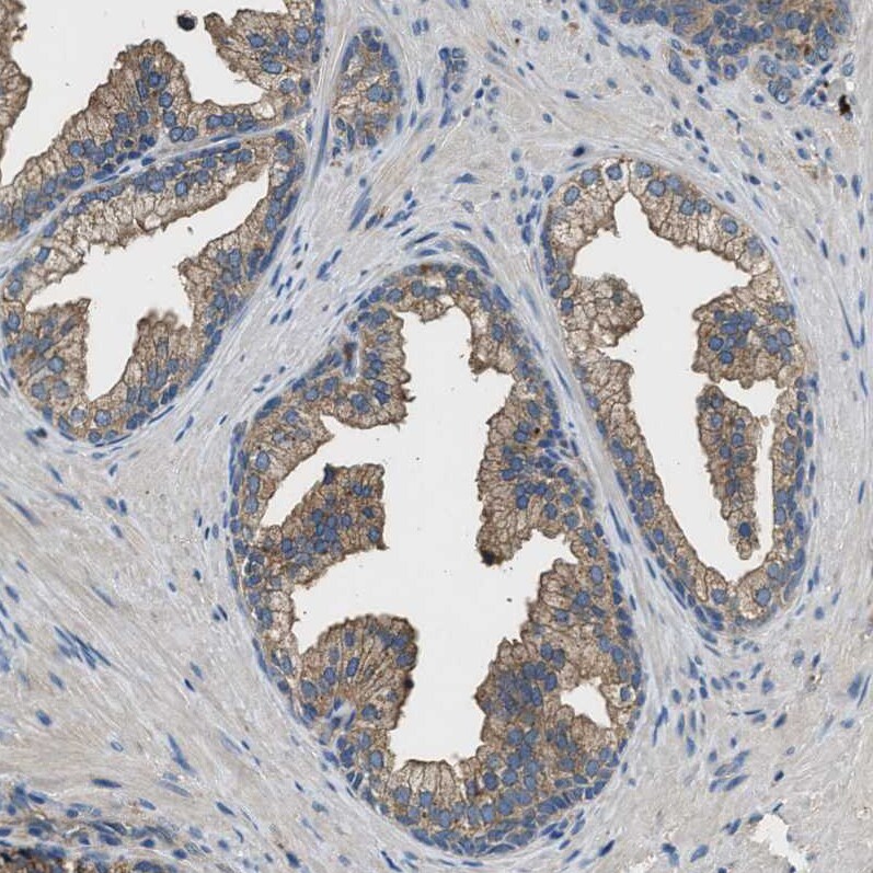 BLOC1S1 Antibody Immunohistochemistry-Paraffin: BLOC1S1 Antibody [NBP1-88583]