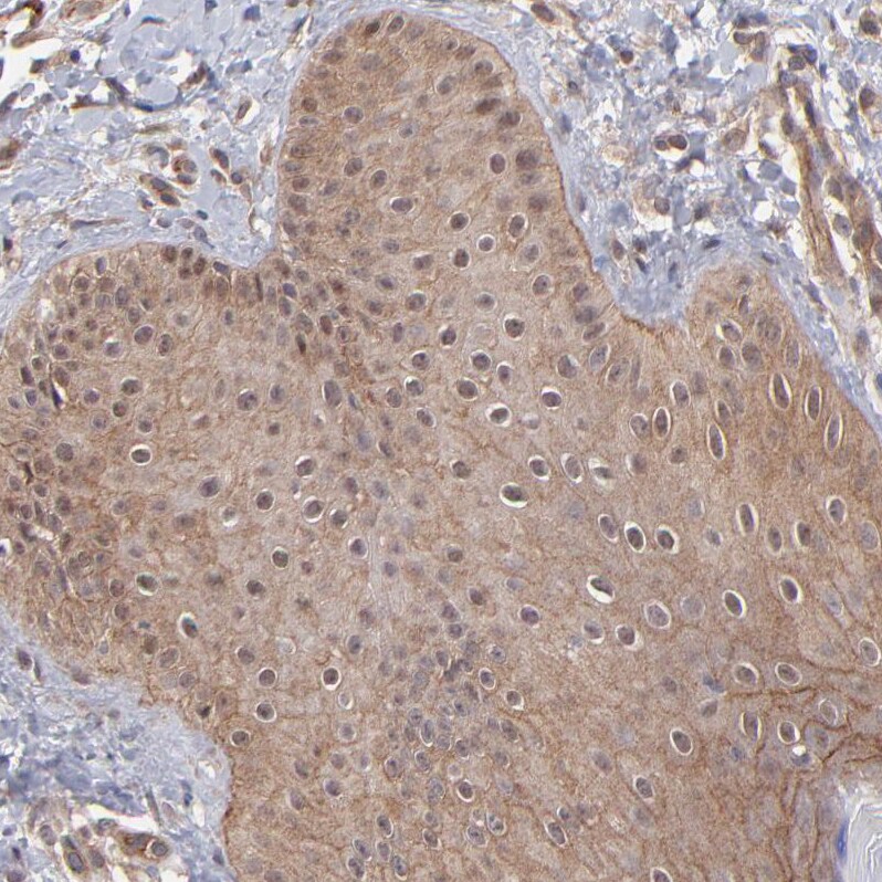 STAP2 Antibody - BSA Free Immunohistochemistry-Paraffin: STAP2 Antibody - BSA Free [NBP1-88586]