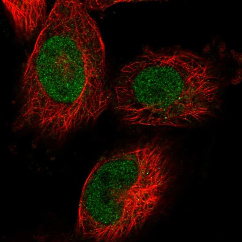 KBTBD4 Antibody - BSA Free Immunocytochemistry/ Immunofluorescence: KBTBD4 Antibody - BSA Free [NBP1-88587]