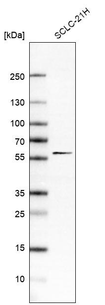 KBTBD4 Antibody - BSA Free Western Blot: KBTBD4 Antibody - BSA Free [NBP1-88587]