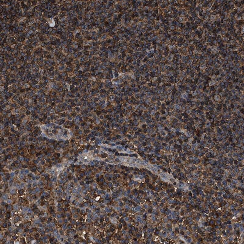 KBTBD2 Antibody - BSA Free Immunohistochemistry-Paraffin: KBTBD2 Antibody [NBP1-88588]