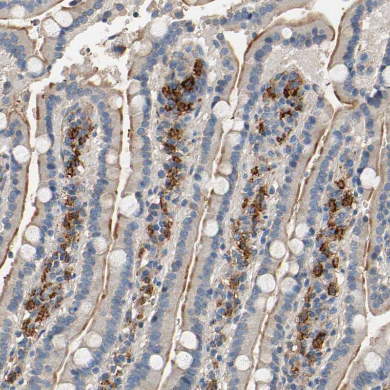SUSD2 Antibody - BSA Free Immunohistochemistry-Paraffin: SUSD2 Antibody - BSA Free [NBP1-88589]