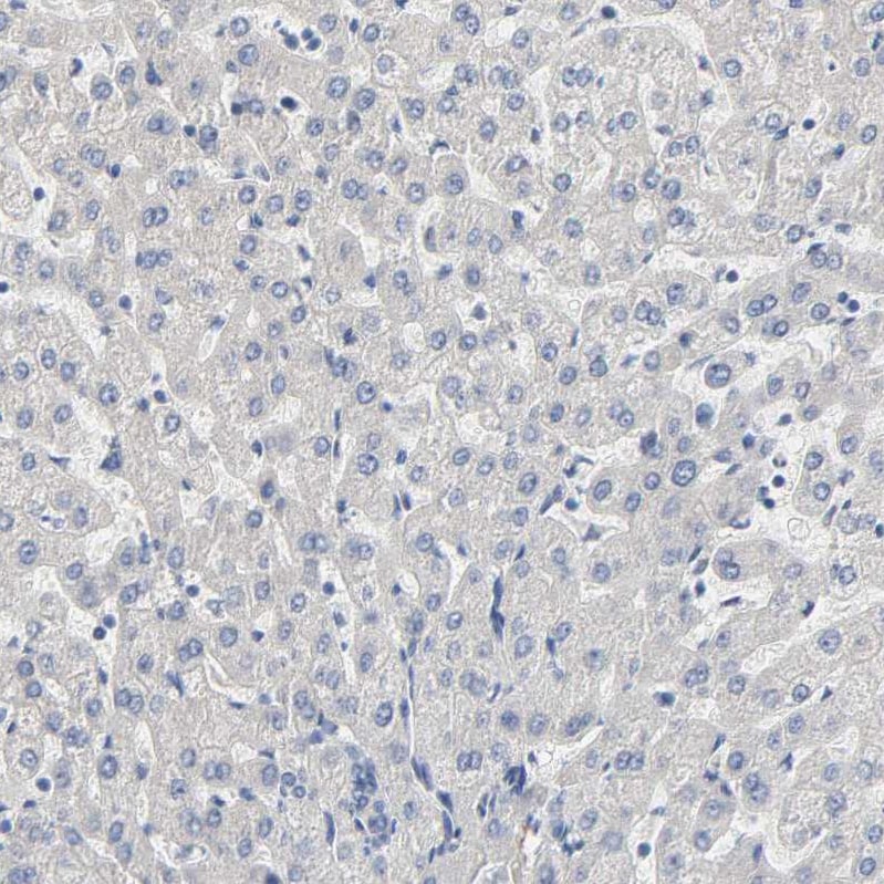 FAM118A Antibody - BSA Free Immunohistochemistry-Paraffin: FAM118A Antibody - BSA Free [NBP1-88590]