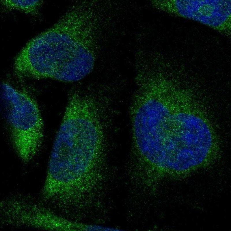 PTPLAD1 Antibody - BSA Free Immunocytochemistry/ Immunofluorescence: PTPLAD1 Antibody [NBP1-88597]