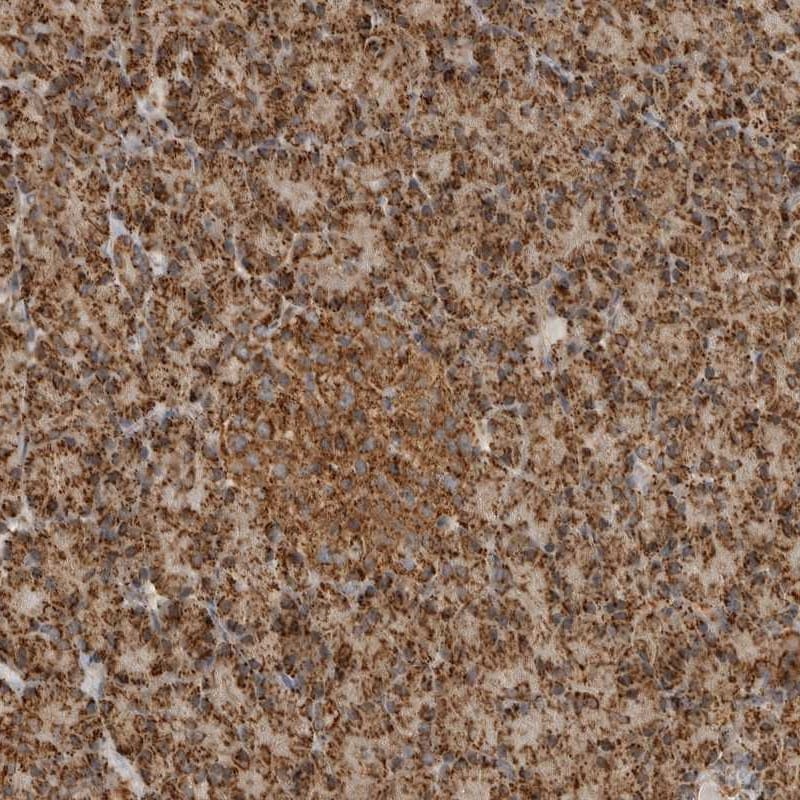 BMP2K Antibody - BSA Free Immunohistochemistry: BMP2K Antibody - BSA Free [NBP1-88603]