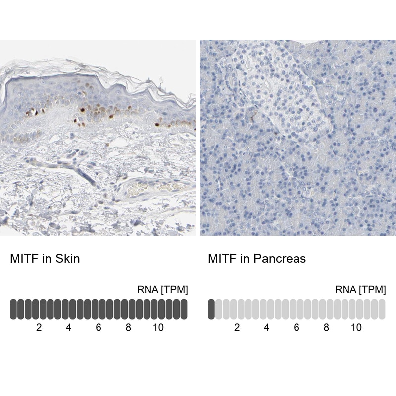 MITF Antibody - BSA Free Immunohistochemistry-Paraffin: MITF Antibody [NBP1-88618]