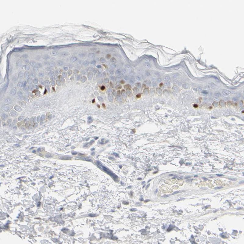 MITF Antibody - BSA Free Immunohistochemistry-Paraffin: MITF Antibody [NBP1-88618]