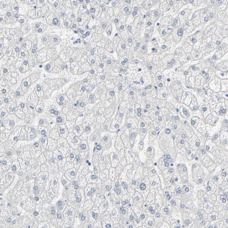 MITF Antibody - BSA Free Immunohistochemistry-Paraffin: MITF Antibody [NBP1-88618]