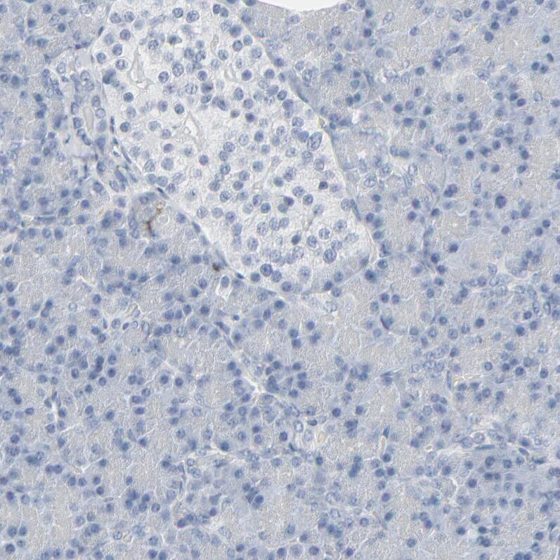 MITF Antibody - BSA Free Immunohistochemistry-Paraffin: MITF Antibody [NBP1-88618]