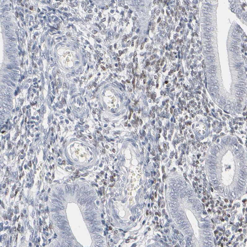 MITF Antibody - BSA Free Immunohistochemistry-Paraffin: MITF Antibody [NBP1-88618]