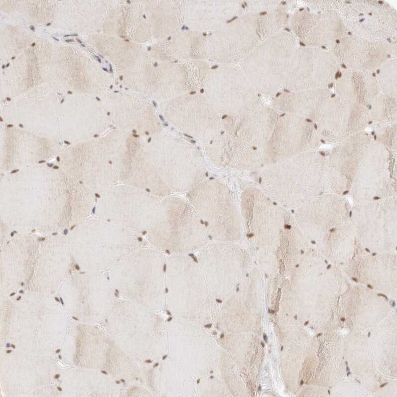 ASCL3 Antibody - BSA Free Immunohistochemistry-Paraffin: ASCL3 Antibody [NBP1-88635]