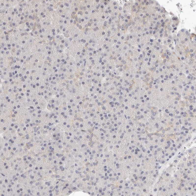 ASCL3 Antibody - BSA Free Immunohistochemistry-Paraffin: ASCL3 Antibody [NBP1-88635]