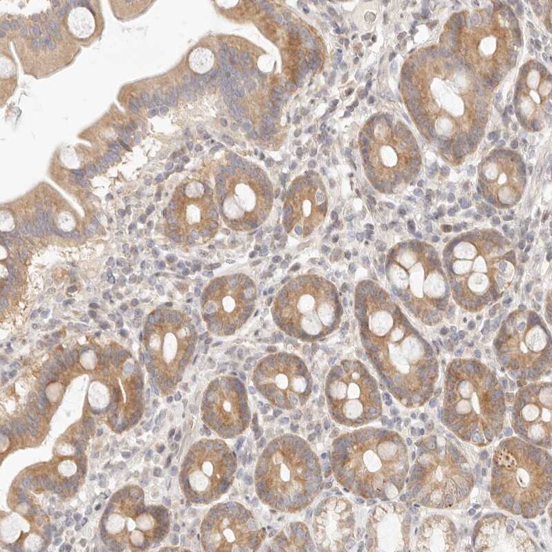 ASCL3 Antibody - BSA Free Immunohistochemistry-Paraffin: ASCL3 Antibody [NBP1-88635]