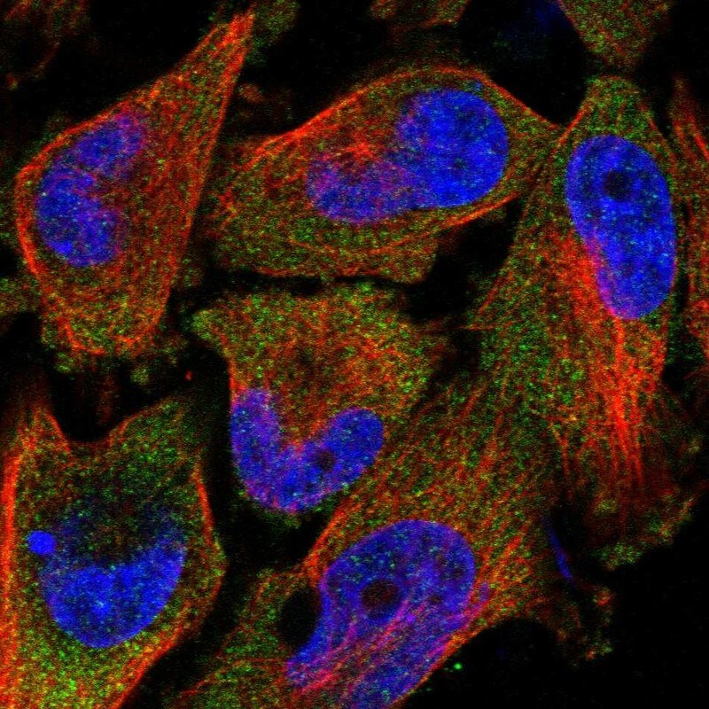TAL2 Antibody - BSA Free Immunocytochemistry/ Immunofluorescence: TAL2 Antibody [NBP1-88638]