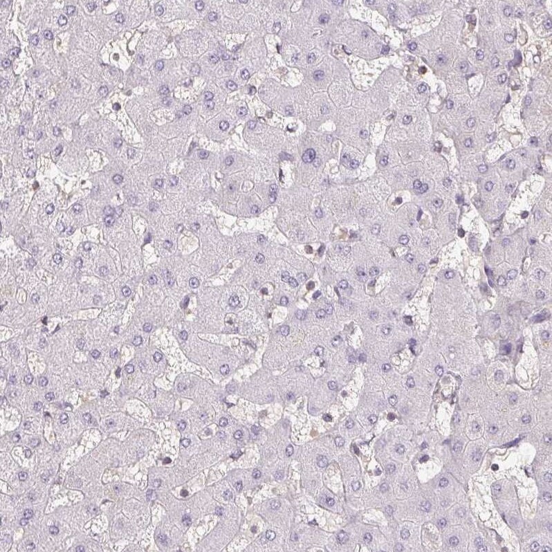 BLMH/Bleomycin Hydrolase Antibody - BSA Free Immunohistochemistry-Paraffin: BLMH/Bleomycin Hydrolase Antibody [NBP1-88640]