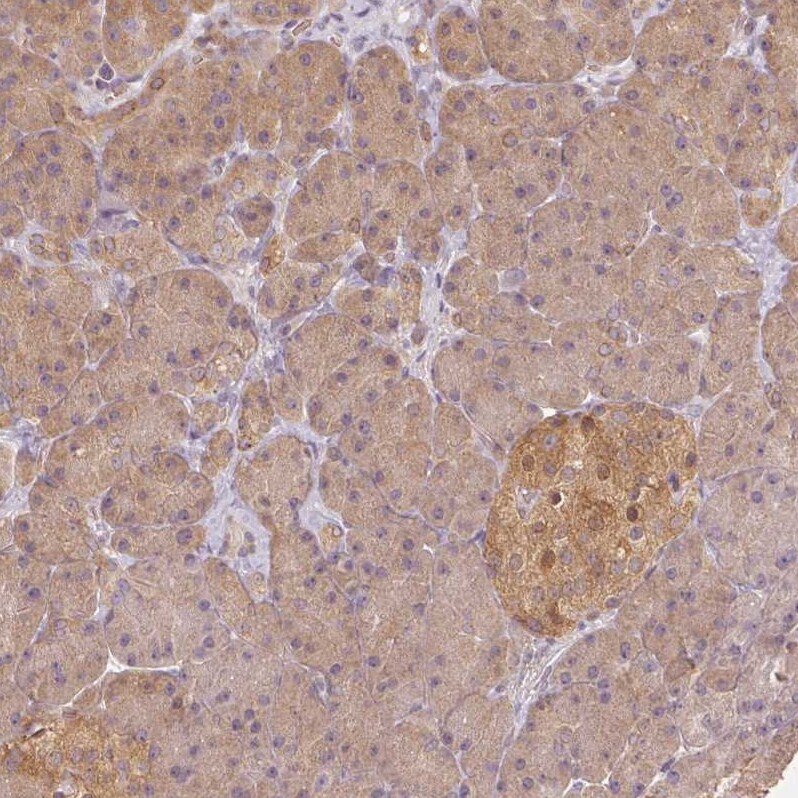BLMH/Bleomycin Hydrolase Antibody - BSA Free Immunohistochemistry-Paraffin: BLMH/Bleomycin Hydrolase Antibody [NBP1-88640]