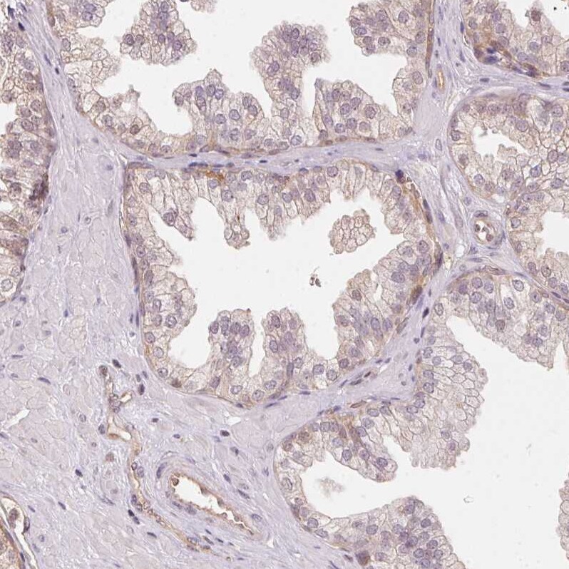 BLMH/Bleomycin Hydrolase Antibody - BSA Free Immunohistochemistry-Paraffin: BLMH/Bleomycin Hydrolase Antibody [NBP1-88640]