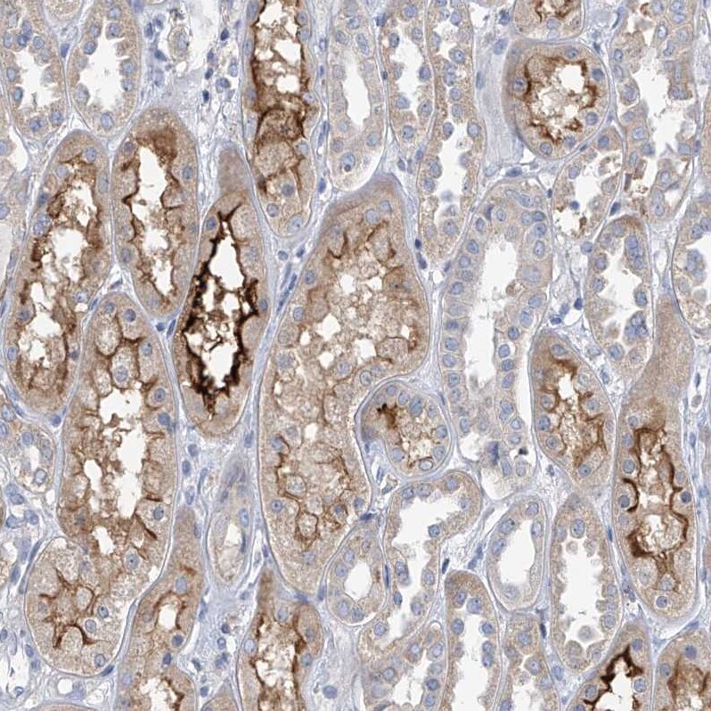 SLC6A12 Antibody - BSA Free Immunohistochemistry-Paraffin: SLC6A12 Antibody [NBP1-88641]