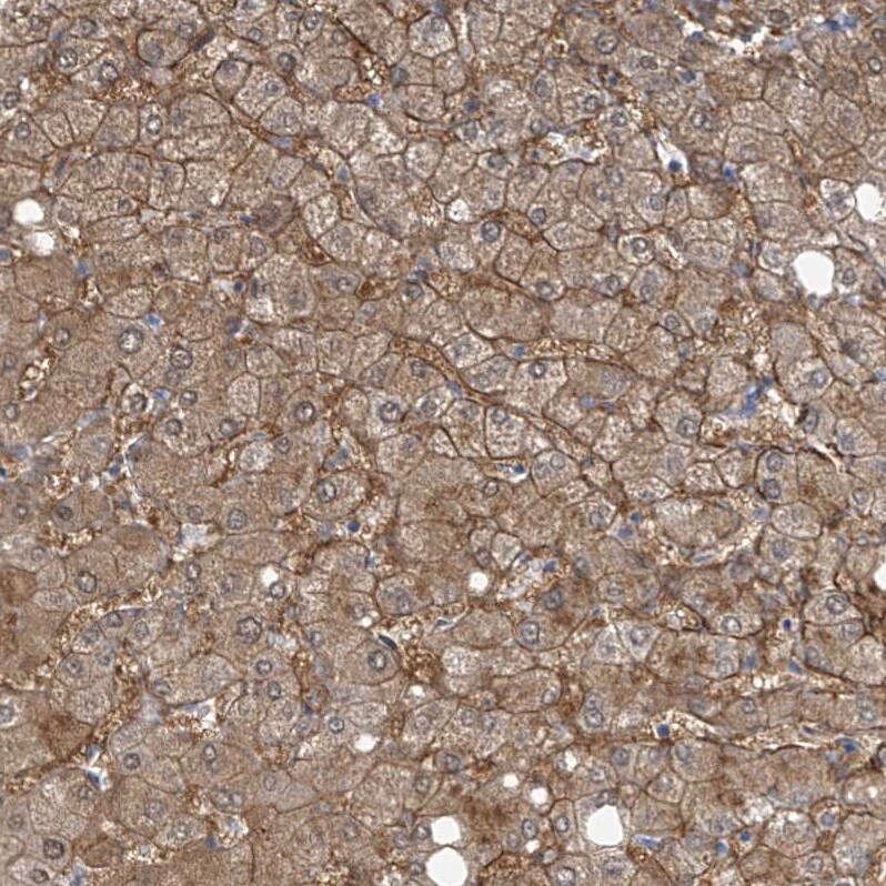 SLC6A12 Antibody - BSA Free Immunohistochemistry-Paraffin: SLC6A12 Antibody [NBP1-88641]
