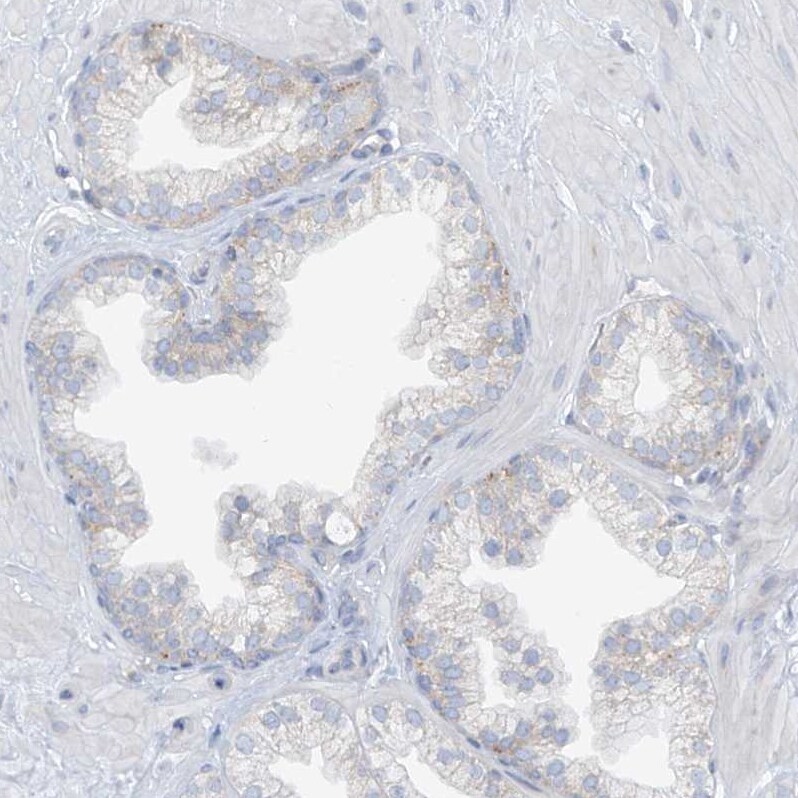 SLC6A12 Antibody - BSA Free Immunohistochemistry-Paraffin: SLC6A12 Antibody [NBP1-88641]