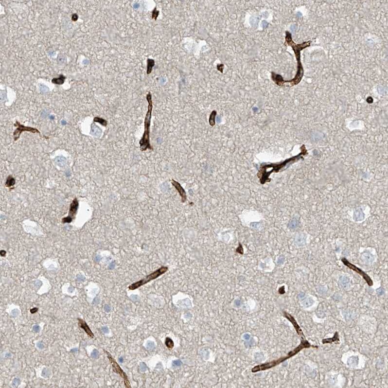 SLC6A12 Antibody - BSA Free Immunohistochemistry-Paraffin: SLC6A12 Antibody [NBP1-88641]